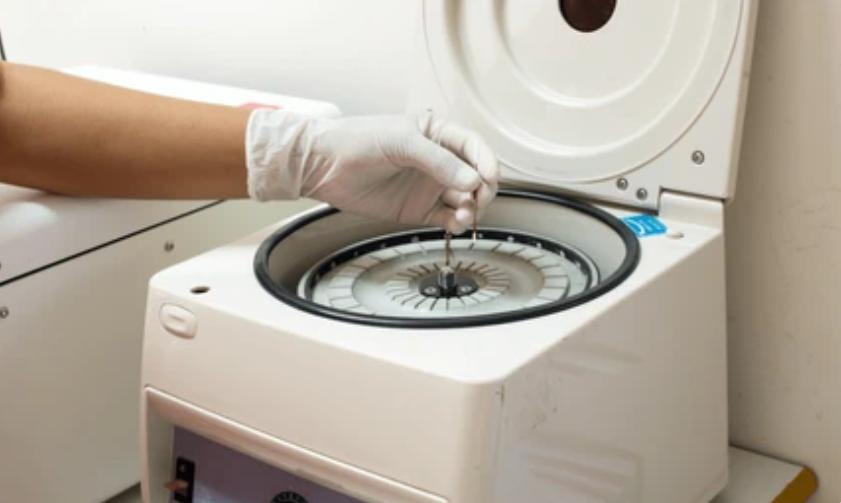 Sedimentation Equilibrium Analytical Ultra Centrifugation (SE-AUC)
