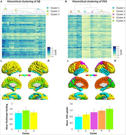 Hierarchical clustering of cortical Aβ deposition (A) and glucose metabolism (B) patterns.