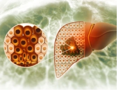 Metabolic flux analysis in hepatic cells