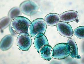 Metabolic Flux Analysis in Yeasts