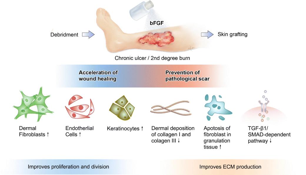 Fig 1. Illustrative overview of the biological actions of bFGF application in chronic ulcer and burn injury involved in accelerating wound healing and preventing pathological scar development.