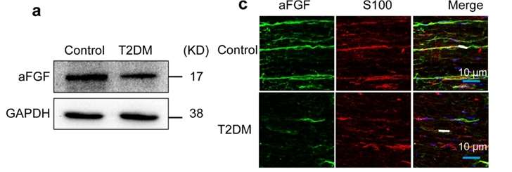 Fig 1. Endogenous levels of aFGF in T2DM mice and SCs.