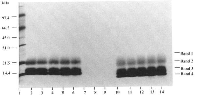 Fig 3. Stability evaluation by SDS-PAGE of LEUKINE