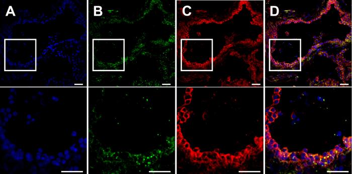 Immunofluorescent staining results of co-localize.