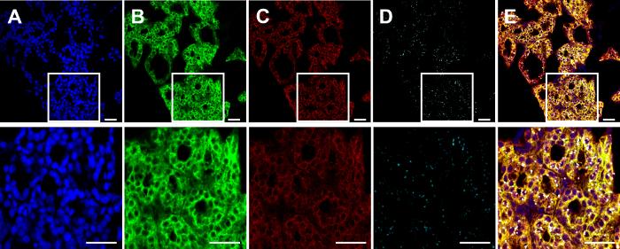 Immunofluorescent staining results of co-localize.