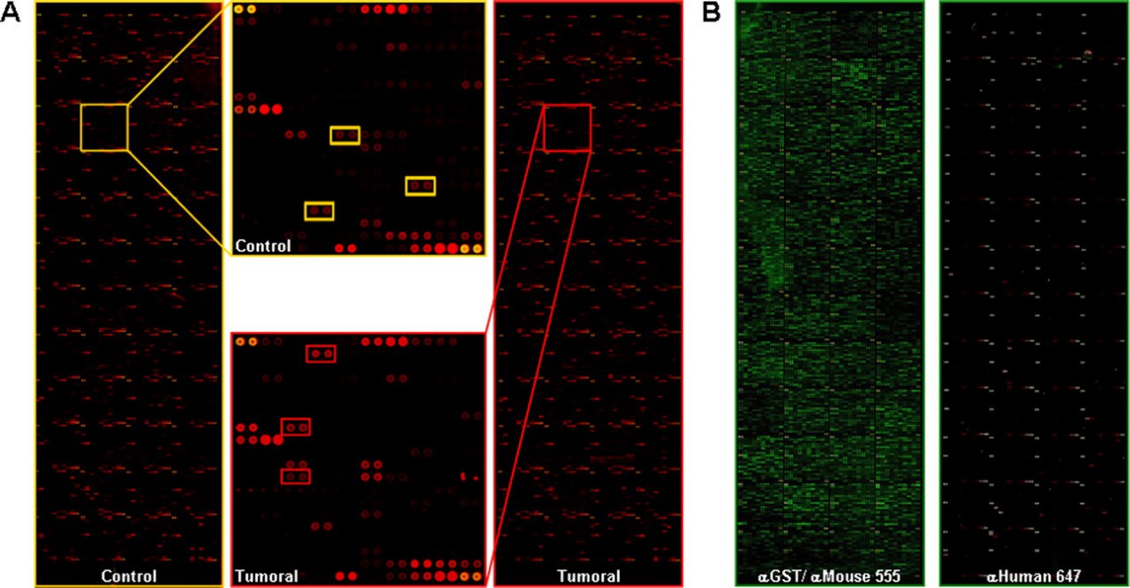 Identification of proteins that were reactive to autoantibodies