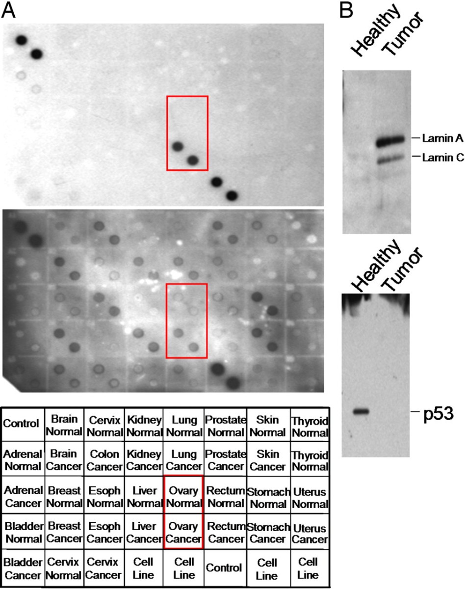 WB analysis of candidate tumor markers.