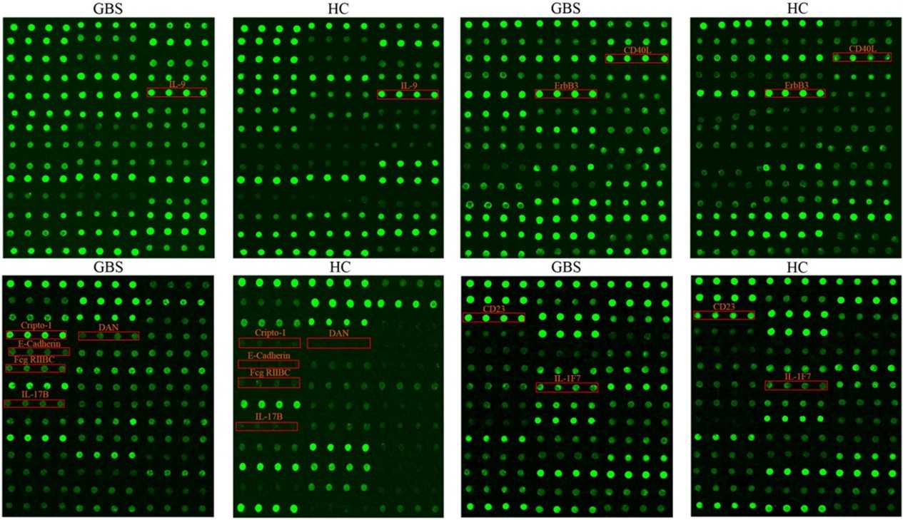 The profiles of top 10 DEPs in patients.