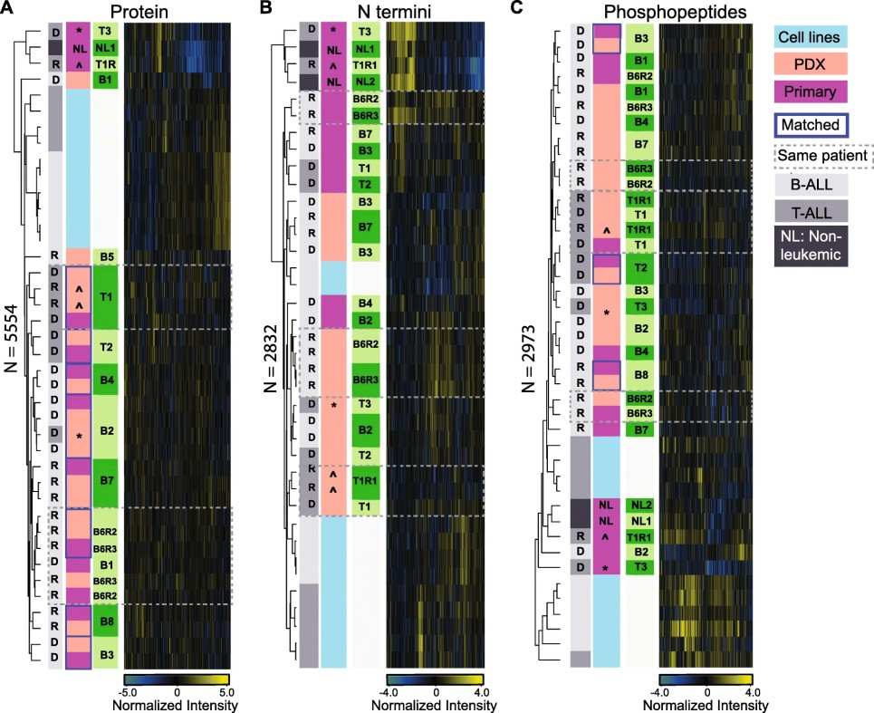 Pediatric ALL proteome landscape. 