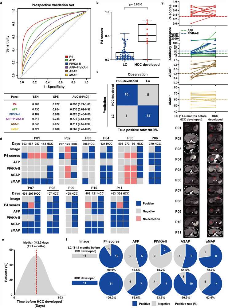 Longitudinal monitoring data showing P4 panel scores predicting HCC conversion a median of 11.4 months before imaging diagnosis