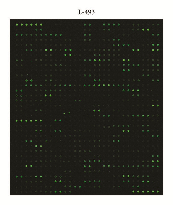 Fluorescence images of the semi-quantitative protein array.