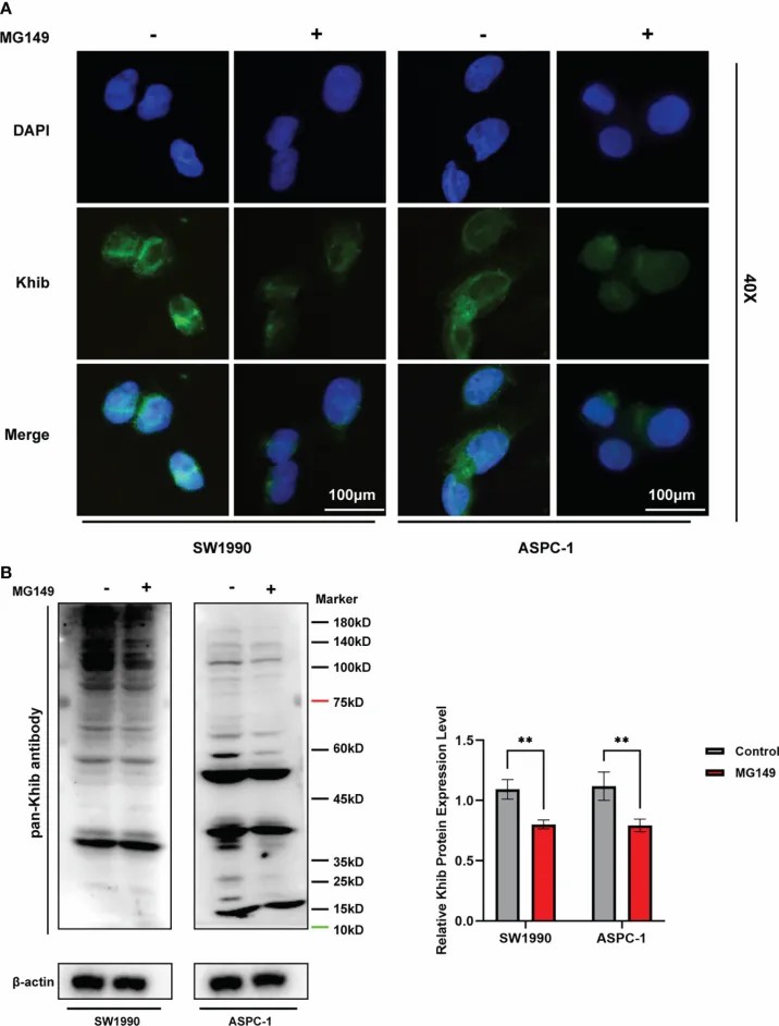 MG149 inhibits Khib in pancreatic cancer cells