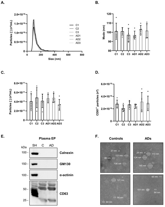 Key results from Soares Martins et al. 2024 (Int J Mol Sci): high-density antibody microarray platform with 1,145 pan-specific and 913 phosphosite-specific antibodies, extracellular particle isolation workflow from serum samples, differentially phosphorylated proteins between Alzheimer's disease and control groups, machine learning classification performance, and pathway analysis of dysregulated signaling in AD.
