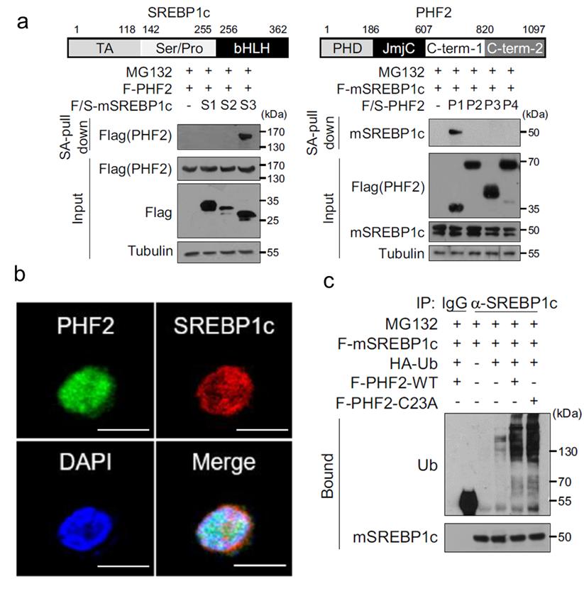 Impact of palmitoylation on SREBP1c ubiquitination mediated by PHF2 in liver cancer.