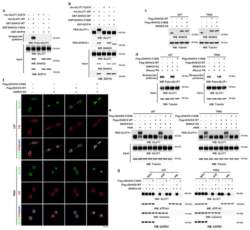 Role of DHHC9 in the palmitoylation of GLUT1.