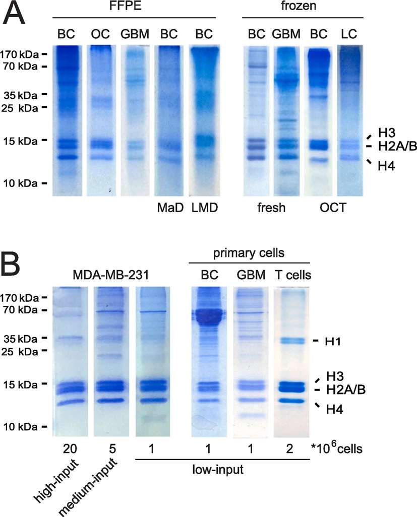 Histones isolated from primary samples.