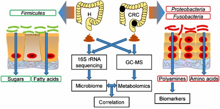 Integrated microbiome and metabolome analysis reveals a novel interplay between commensal bacteria and metabolites in colorectal cancer.