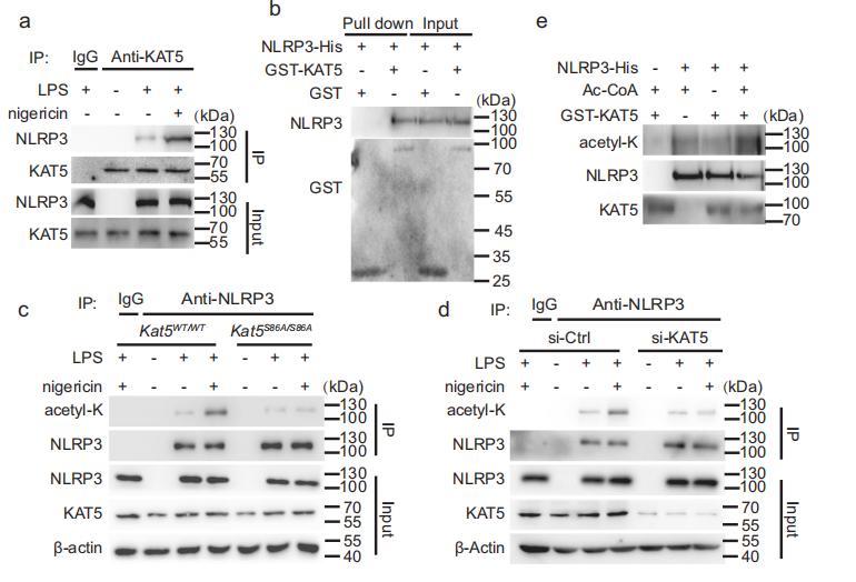 KAT5 mediates NLRP3 acetylation