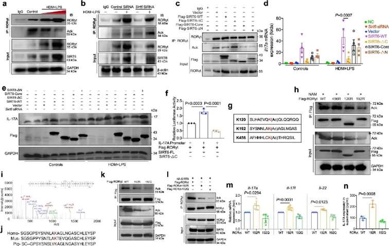 SIRT6 Targets Deacetylation of RORγt K192 Site