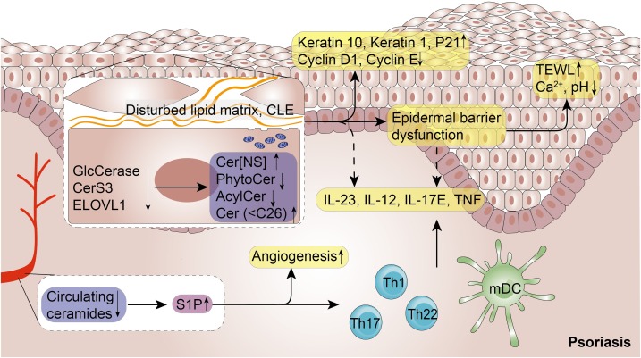 Ceramide and Its Role in Skin Diseases