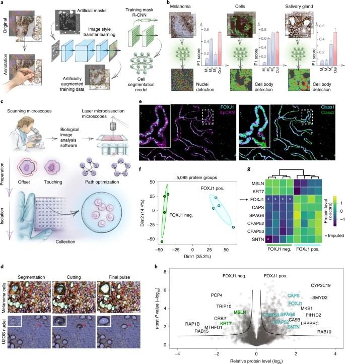Deep Visual Proteomics workflow concept.