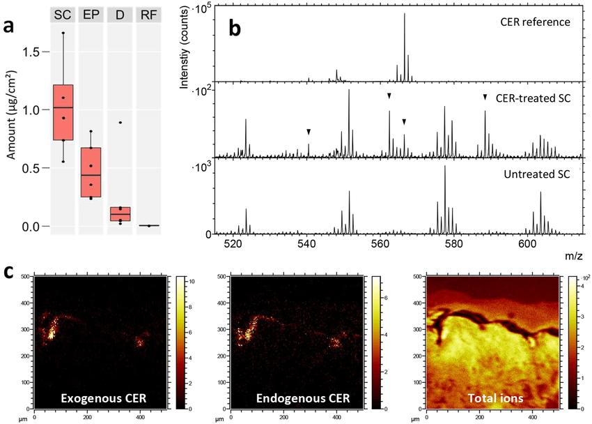 Detection and localization of topically applied ceramide in skin cross sections