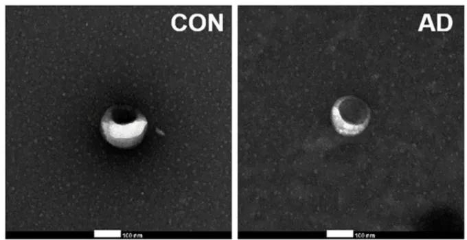 Identifying Urinary Exosomal Biomarkers for Early Alzheimer's Detection