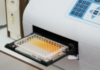 Enzyme-linked immunosorbent assay.