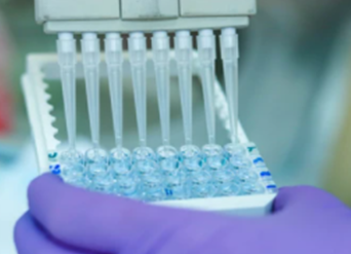 Enzyme-linked immunosorbent assay (ELISA).