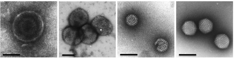 Diagnosis of viral infections by transmission electron microscopy (TEM).